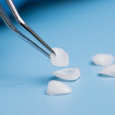 Veneers lying on a table