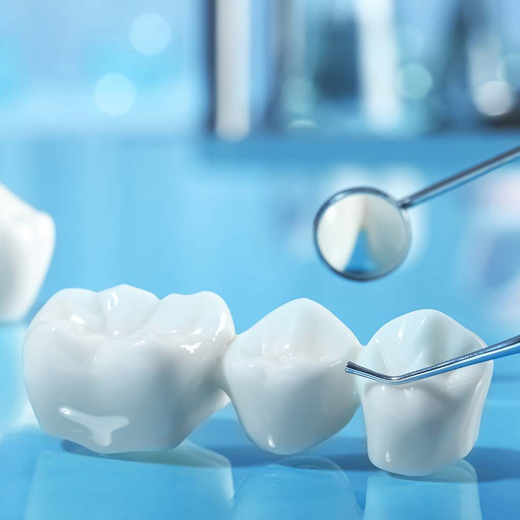 Dental Crowns and Bridges